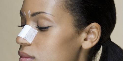 Rhinoplasty: 6 questions to ask yourself before you start